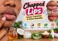 6 Fastest Way To Heal Chapped Lips Naturally