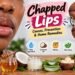 6 Fastest Way To Heal Chapped Lips Naturally